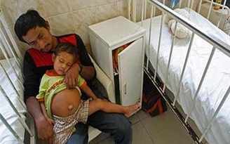 Cậu bé 3 tuổi mang người anh em sinh đôi trong bụng